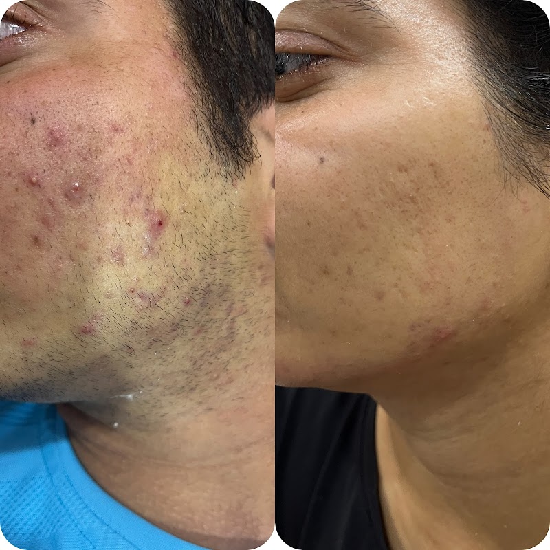 Luhach Beauty Hub - Luxury salon & skin clinic